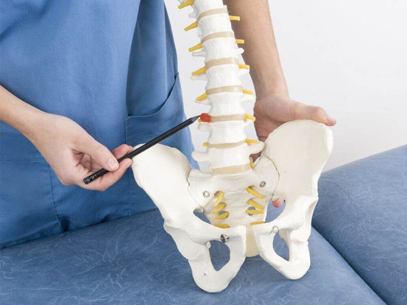 ¿Es posible hacer una tabla para una hernia de la columna lumbar?