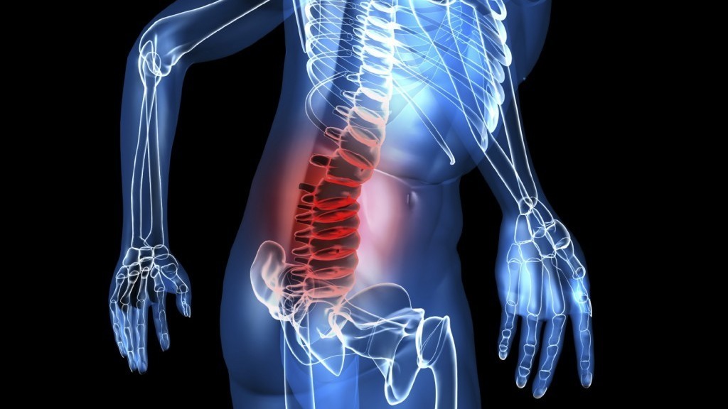 Herniated Disc (Neck And Back): Symptoms, Causes, Treatment, Relief, Surgery